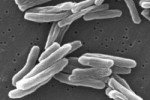 Туберкулезные бактерии "дирижируют" иммунитетом