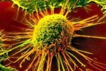 Сенсация: антиоксиданты помогают раковым опухолям