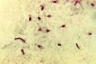 Древнейшие бактерии позволят справиться с твердыми опухолями
