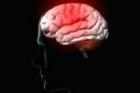 Размер отделов мозга влияет на тяжесть симптомов простуды