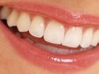 Мифы о стоматологии