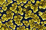 Новый штамм метициллин-резистентного золотистого стафилококка обнаружен в Великобритании