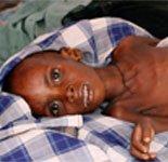 В Сомали бушует эпидемия холеры
