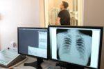 Британцы считают рентген устаревшим методом диагностики туберкулеза