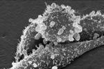 Микрочастицы с лекарством станут Троянским конем для раковых опухолей