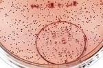 Бактерии могут «прятаться»