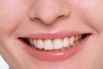 Японские ученые создали материал для восстановления эмали зубов