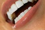 Что вредно для зубной эмали