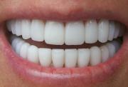 Как сохранить в здоровом виде зубы