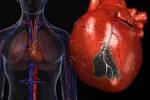 Американские ученые нашли способ восстановления сердца после инфаркта
