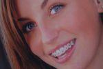 Лингвальная ортодонтия – невидимый секрет очаровательной улыбки