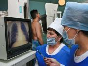 Ставропольским медикам поручили усилить защиту от туберкулёза