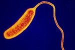 В Нью-Йорке подтверждены три случая доминиканской холеры