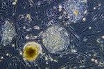 Переворот в медицине: в спинном мозге найден новый тип клеток